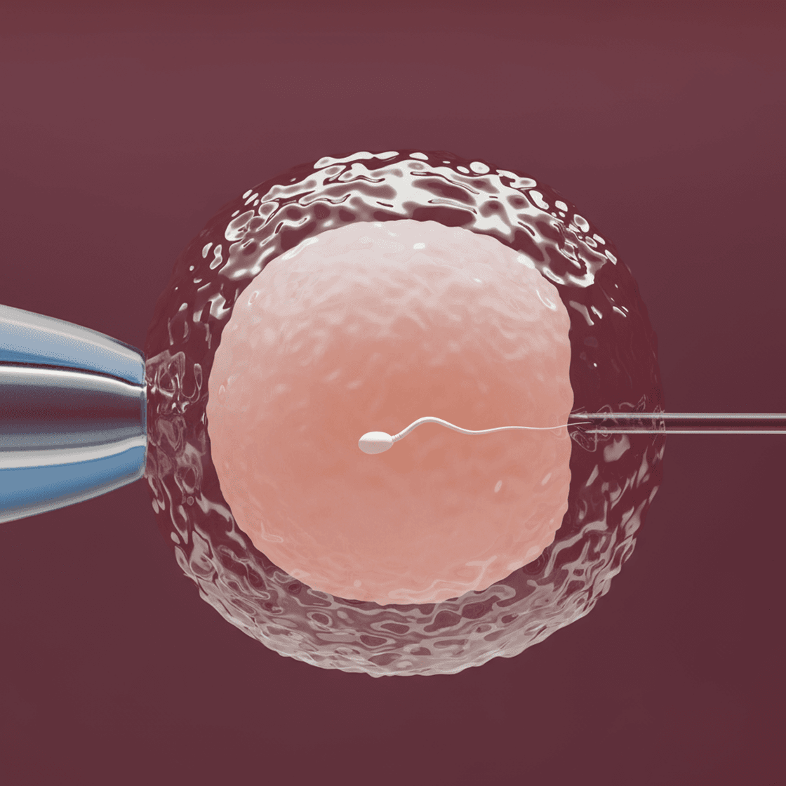 IVF Treatment